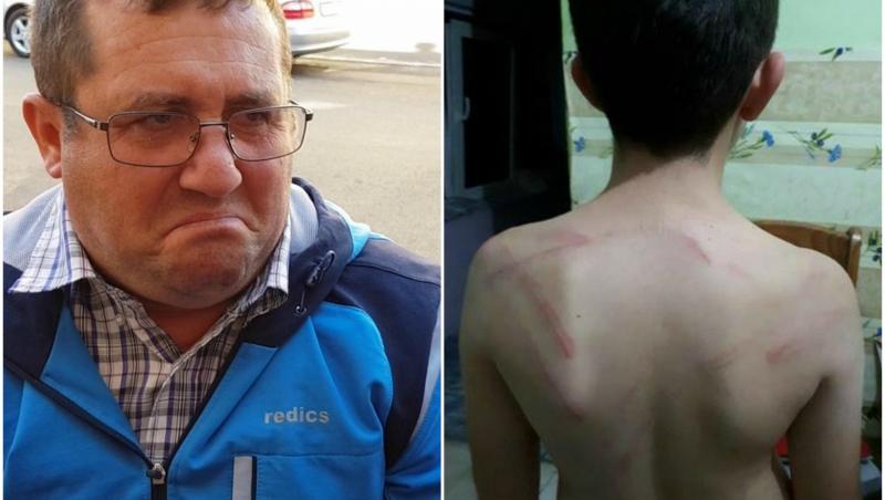 Un copil de 11 ani a fost pedepsit în cel mai crunt mod! Unchiul lui l-a agresat cu un cablu metalic pentru 200 de lei