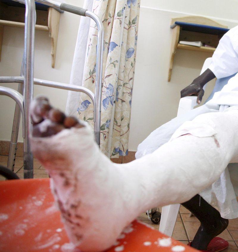 &nbsp;Medici ortopezi, obligați să lucreze cu un ghips care nu se &icirc;ntărea! Reacția unității medicale: &rdquo;S-a cerut &icirc;nlocuirea materialelor!&rdquo;