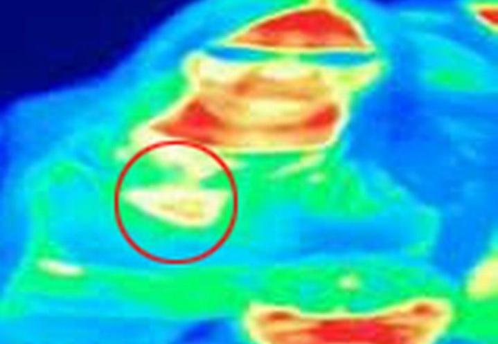 A aflat că are o boală gravă &icirc;n timpul unei vizite la un obiectiv turistic! Ce a văzut &icirc;n corpul ei pe o cameră cu termoviziune a șocat-o! &bdquo;Mi-a salvat viața&rdquo;