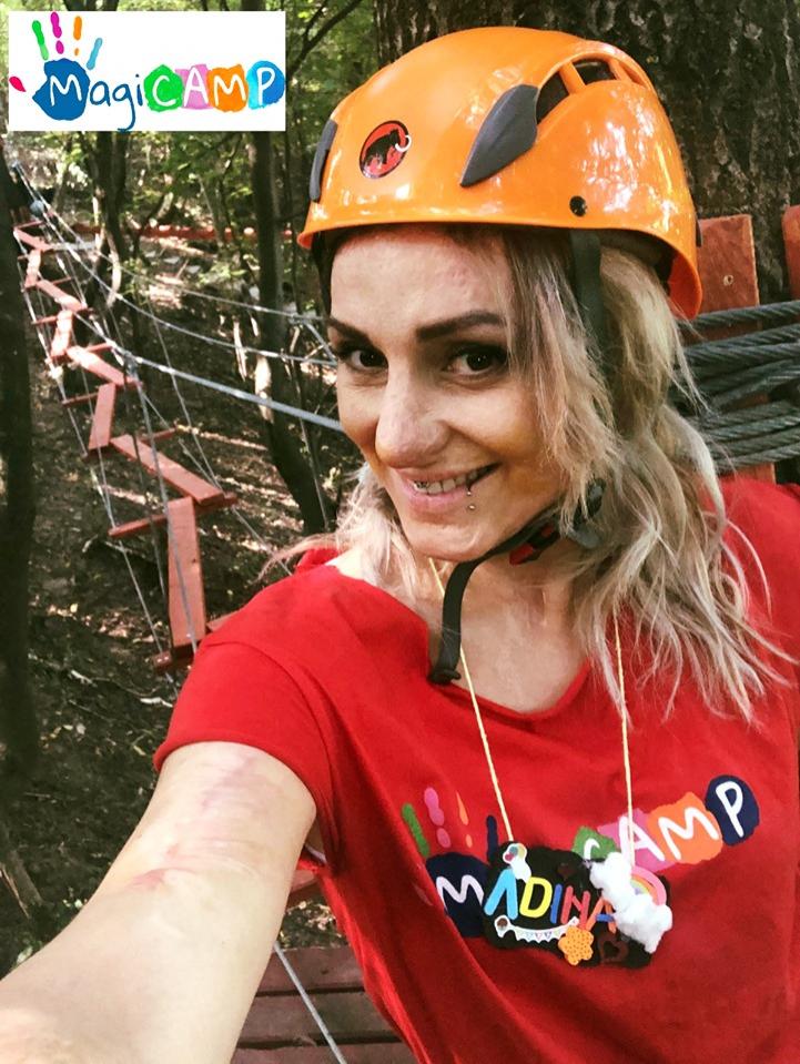 Ea e Adina Apostol, iar chipul i-a ars &icirc;n Colectiv. Are zece operații de reconstrucție a feței și la patru ani de la tragedie, Adina ajută copiii