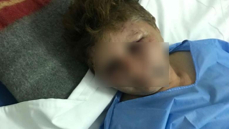 Mărturisiri cutremurătoare făcute de femeia desfigurată de un polițist căruia i-a refuzat avansurile: &rdquo;Mi-a spus că ies doar cu picioarele &icirc;nainte"