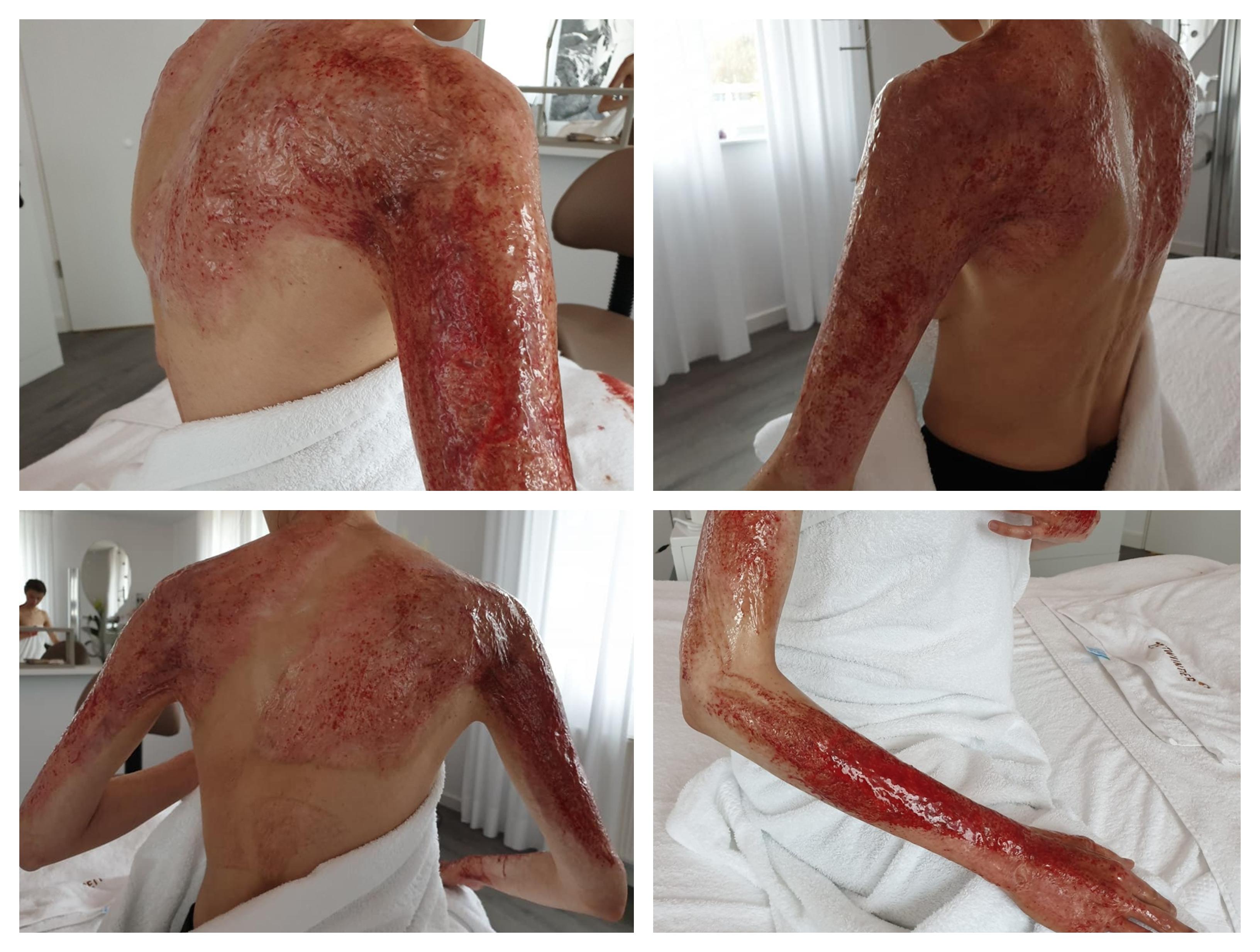 &rdquo;Credeam că voi muri &icirc;n cadă sau &icirc;ntr-un pat murdar de spital, printre așternuturi &icirc;ns&acirc;ngerate, m&acirc;njite cu fragmente din mine, cu scutecul făcut ghem peste neputința mea&rdquo;. Patru ani de la Colectiv