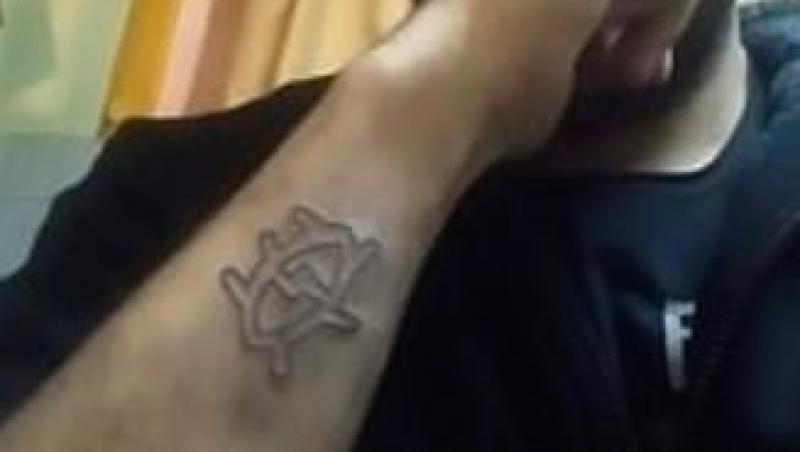 Un tânăr a folosit o răzătoare pentru a-și scoate tatuajul de pe mână! Rezultatul a fost de nedescris!