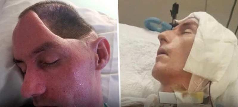 Este de pl&acirc;ns! Acest bărbat a rămas fără jumătate de creier și paralizat după ce a fost atacat de niște nenorociți pe stradă