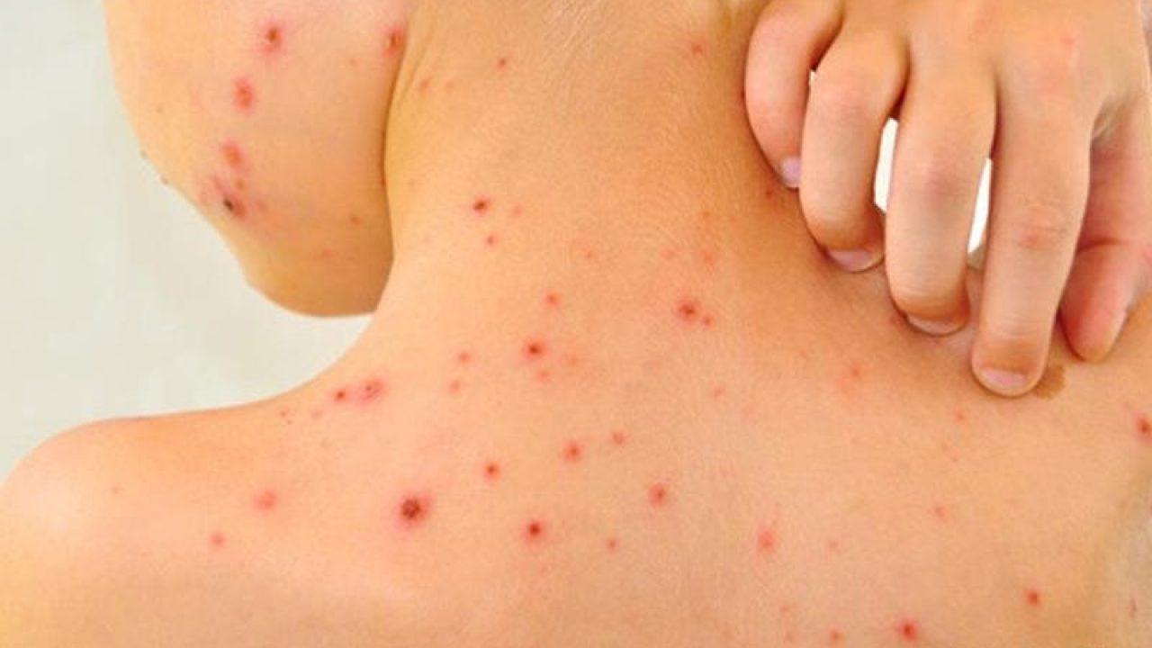 Vaccinarea copiilor, obligatorie! Părinții care se opun vor primi amenzi uriașe: &bdquo;Protecţia &icirc;mpotriva rujeolei reprezintă protejarea copiilor&rdquo;