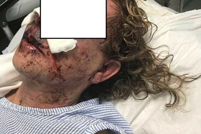 Una dintre femeile bătute &icirc;n Alexandria a rupt tăcerea. Primele declarații despre drama pe care a trăit-o: &rdquo;M-a lovit și am căzut lată!&rdquo;