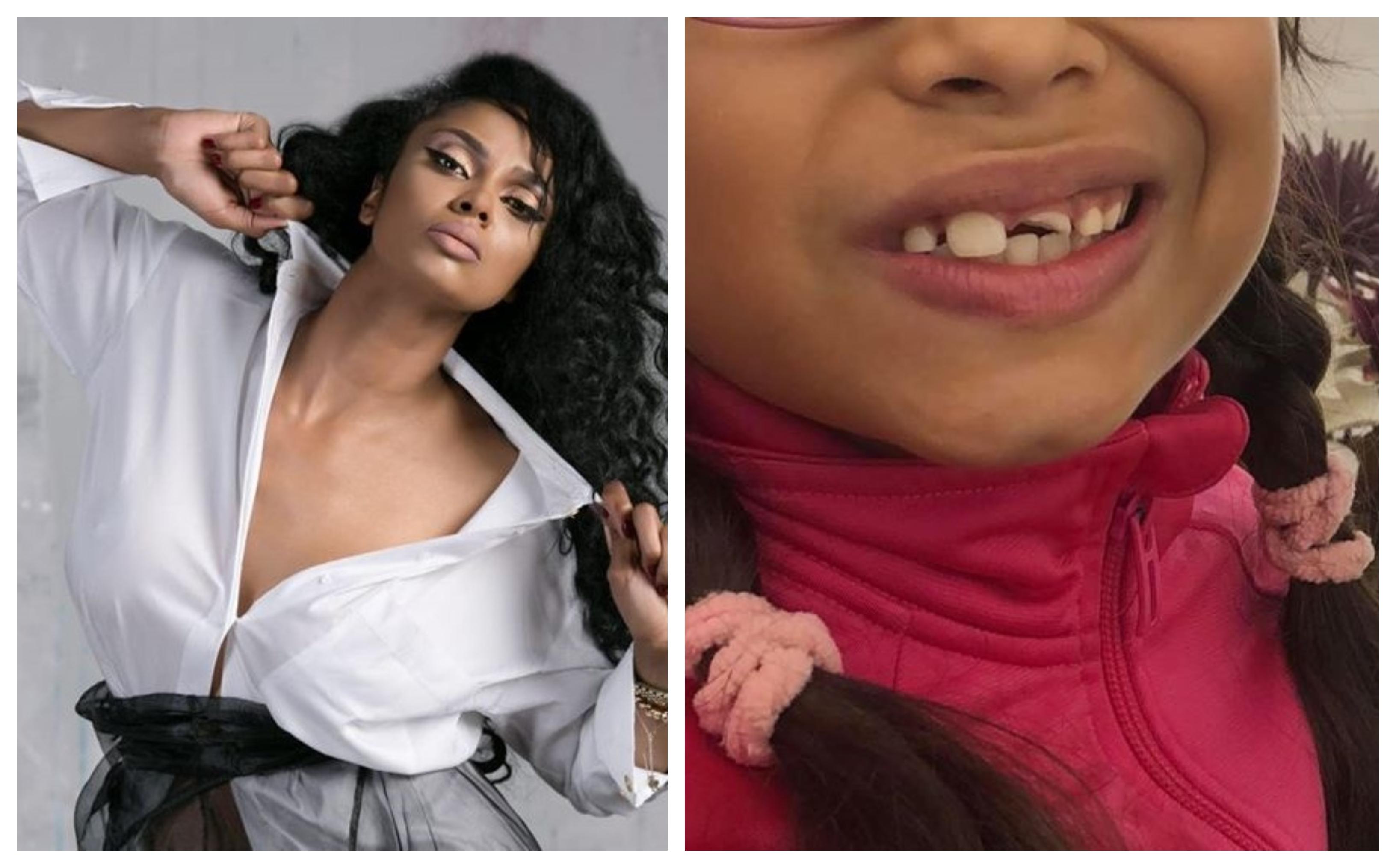 Fiica lui Laurette a fost bătută la școală! Vedeta, apel disperat! &bdquo;Copilul meu nu trebuie bătut, scuipat, batjocorit, doar pentru că are o altă culoare a pielii&rdquo; &ndash; Foto