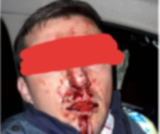 &bdquo;Răzvan e tumefiat. SUTE de lovituri&rdquo;! Un polițist a fost sechestrat și amenințat cu arma, &icirc;n timpul unei urmăriri, &icirc;n V&acirc;lcea: &bdquo;Au apăsat pe trăgaci, dar...&rdquo;