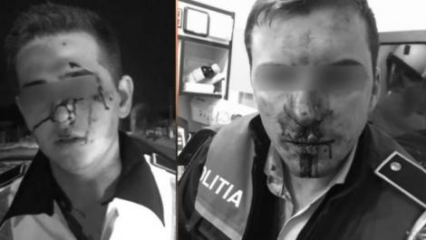 Cazul polițiștilor bătuți cu sălbăticie în Vâlcea: Ce transportau în dubă agresorii