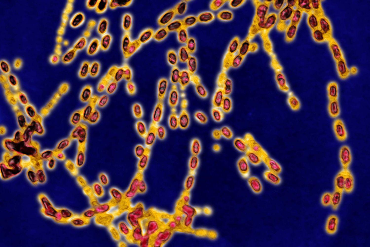 Ultimă oră! Bombă biologică &icirc;n Rom&acirc;nia! A fost convocat Comitetul pentru Situații de Urgență!