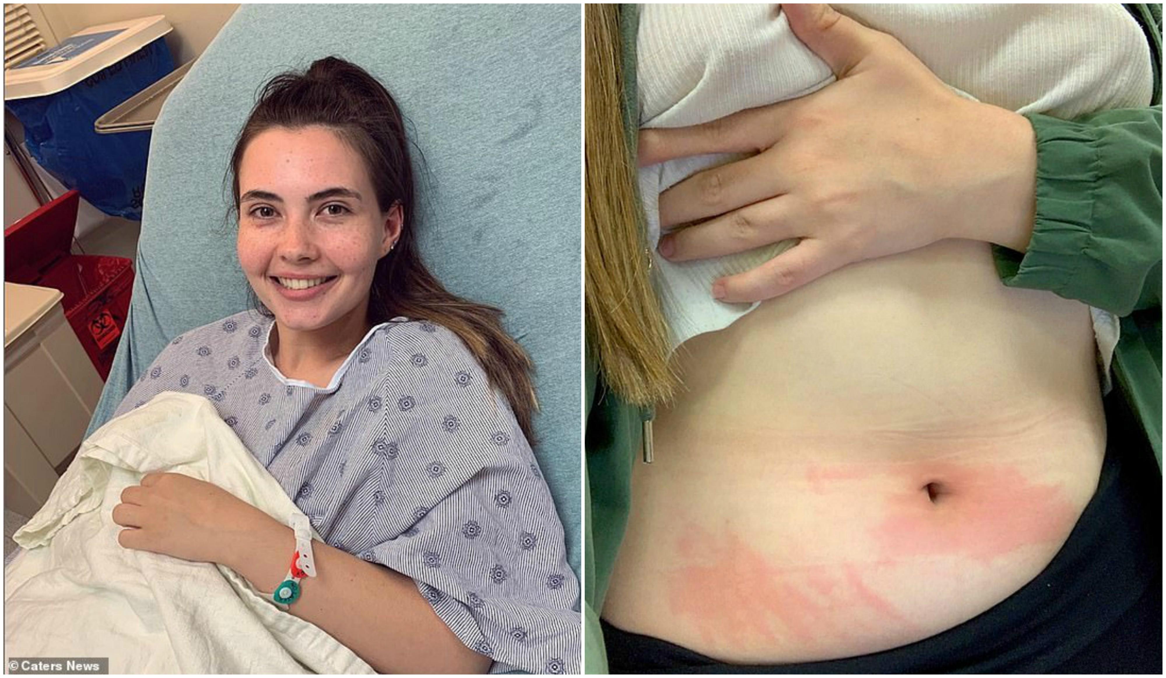 Dacă pl&acirc;nge, transpiră sau face duș, ajunge la spital! Reacția corpului ei la contactul cu apa este &icirc;nfiorătoare! Cum reușește să trăiască. &bdquo;Nu există tratament&rdquo;