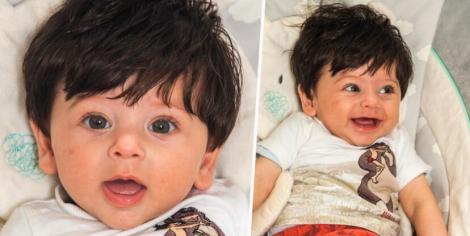 Cazul inedit al unui bebeluș! Când s-a născut avea cinci centimetri de păr negru și gros și a continuat să crească!  „Arată la fel ca Mowgli!”