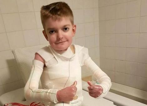 Un băiat de 14 ani și-a dorit să moară, fiindcă nu a mai suportat durerea! Boala cumplită ce-i face pielea să cadă!