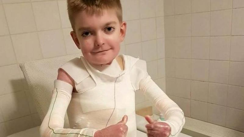 Un copil cu o boală rară de piele a avut parte de surpriza vieții sale