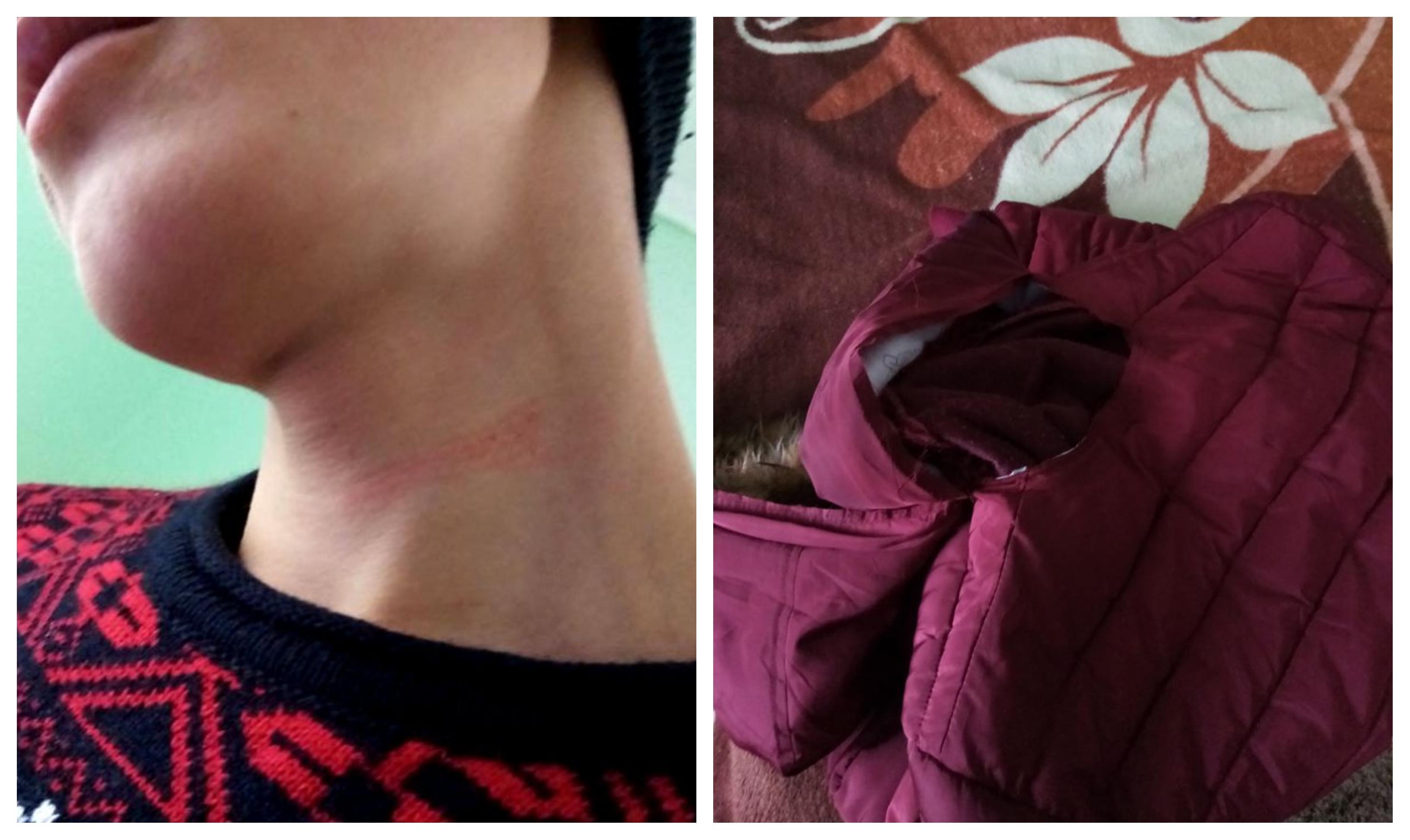 &bdquo;L-a făcut prost și dobitoc, i-a rupt geaca și l-a zg&acirc;riat pe g&acirc;t!&rdquo;. Un elev a fost agresat de un profesor, la un liceu din Botoșani! Motivul pentru care cadrul didactic l-a atacat