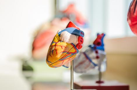 Ce este cardiopatia ischemică și cum poate fi diagnosticată