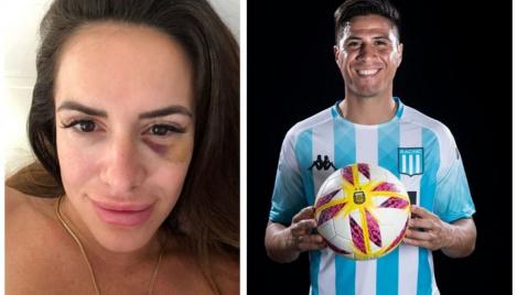 Fotbalist, acuzat de partenera de viață că a snopit-o în bătaie: ”Trăiesc un coșmar cu el!” Femeia ar fi fost lovită în față și târâtă prin casă
