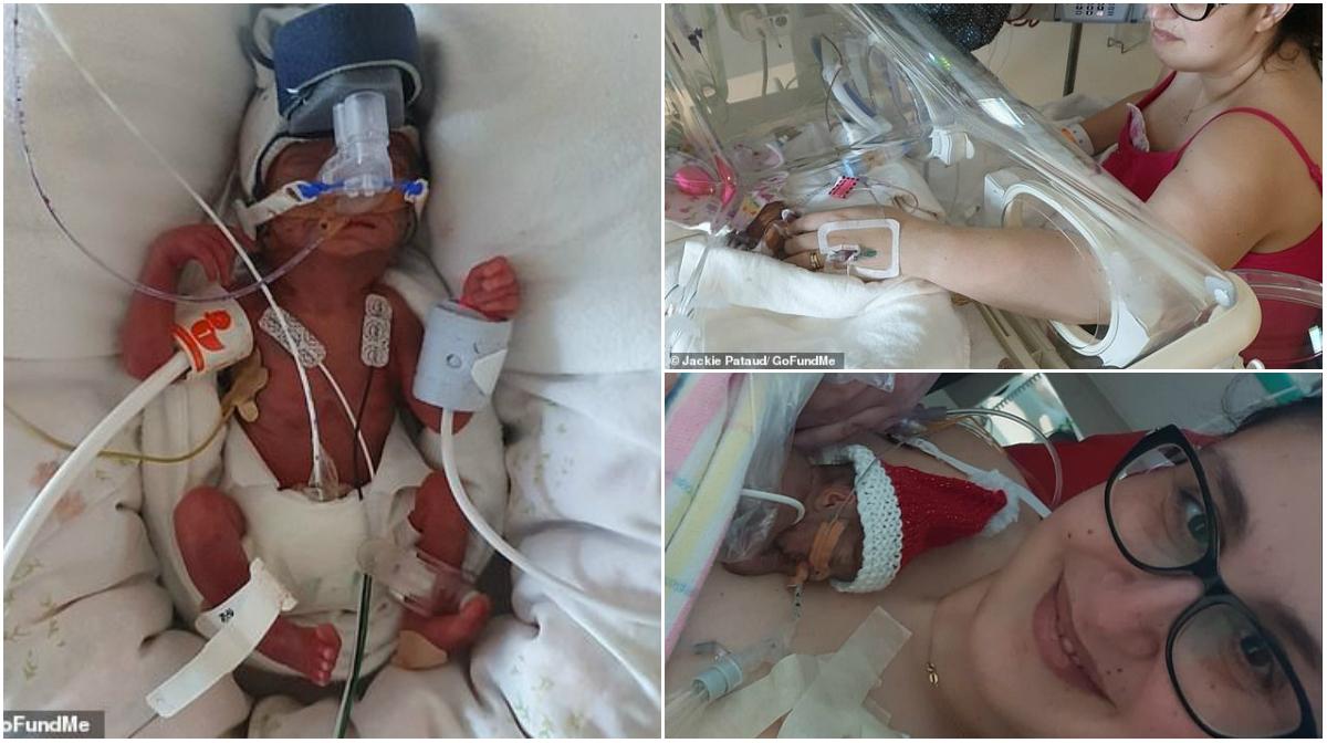 Bebelușul minune! Amalia avea 411 grame c&acirc;nd a venit pe lume, după ce mama ei a &bdquo;pierdut mai multe sarcini dec&acirc;t a suportat să numere&rdquo;