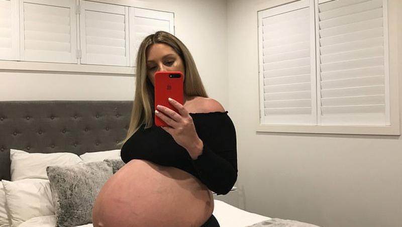 ”O să ai tripleți sau aștepți un cal?” O femeie de 30 de ani, criticată dur pe internet, după ce burta de gravidă i-a crescut prea mult