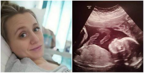 Copilul nenăscut al unei tinere însărcinate, operat şi pus înapoi în pântece de medici! Mama:”Nu s-a schimbat nimic. E o fetiță specială!”