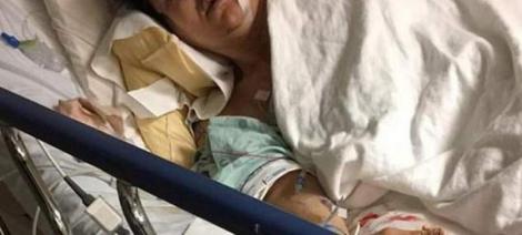 A rămas mutilată pe viață după ce și-a salvat fiul de la moarte! S-a dus la spital cu fața străpunsă de o săgeată. Imagini tulburătoare! – Foto