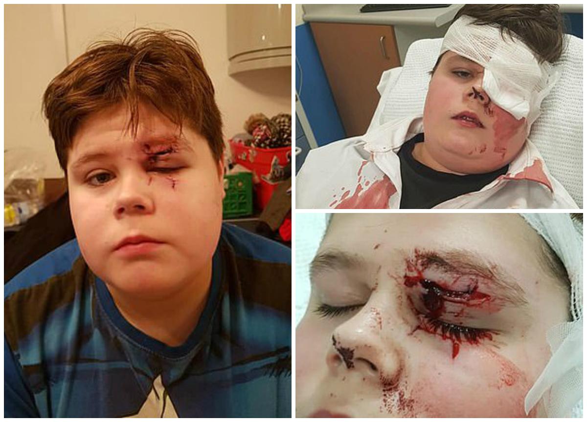 A fost la un pas să orbească! Un copil a fost bătut și batjocorit pe holurile școlii de un coleg mai mare &bdquo;Am crezut că o să moară. Era plin de s&acirc;nge!&rdquo;