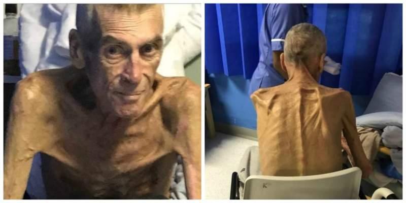 Ce s-a &icirc;nt&acirc;mplat cu bărbatul care c&acirc;ntărea 38 de kilograme și era obligat de stat să muncească! Cazul lui a revoltat sute de mii de oameni