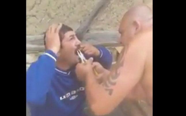 Rom&acirc;n filmat &icirc;n timp ce extrage măseaua unui consătean cu patentul. Votcă pentru dezinfecție, după "extracție". Video