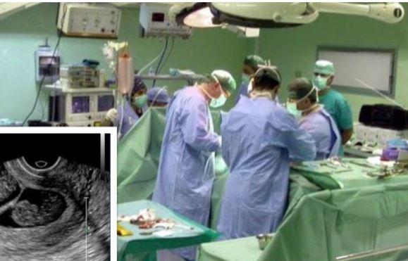 Cazul care a șocat lumea medicală! O fetiță a rămas timp de 13 ani &icirc;n p&acirc;ntecul mamei. Femeia a fost operată de urgență