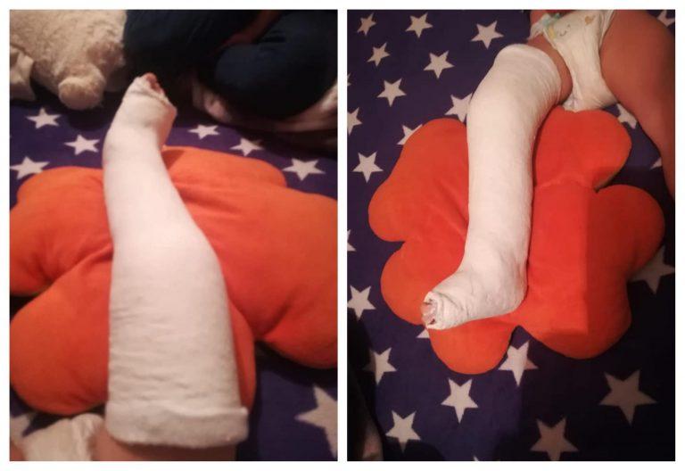 Copil cu piciorul rupt, trimis acasă să ia pastile pentru durere! Mama, acuzații grave: &rdquo;Au spus că e contuzie, deși era fractură!&rdquo;