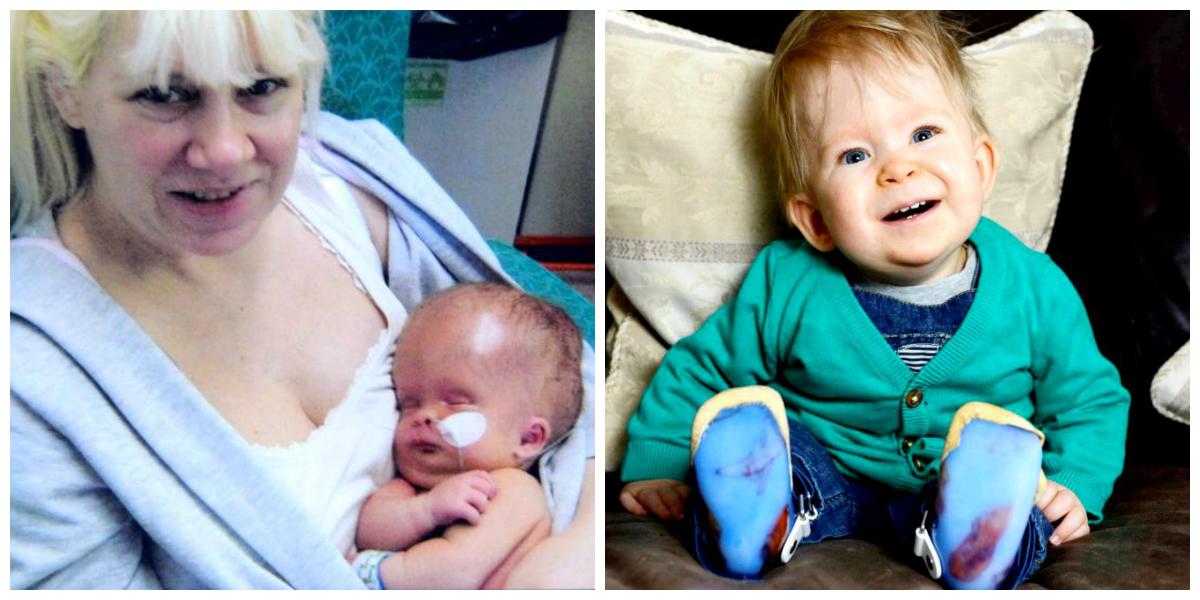 Ce se &icirc;nt&acirc;mplă acum cu băiețelul care s-a născut fără creier! Oamenii sunt uimiți de ce a ajuns să facă