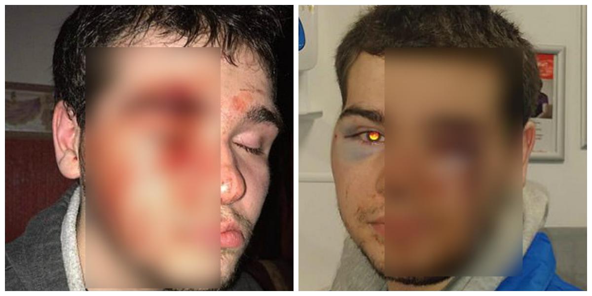 Un adolescent autist a fost bătut cu bestialitate. Mama lui, &icirc;n culmea disperării: &bdquo;Mi-a spus că vrea să se sinucidă&rdquo;