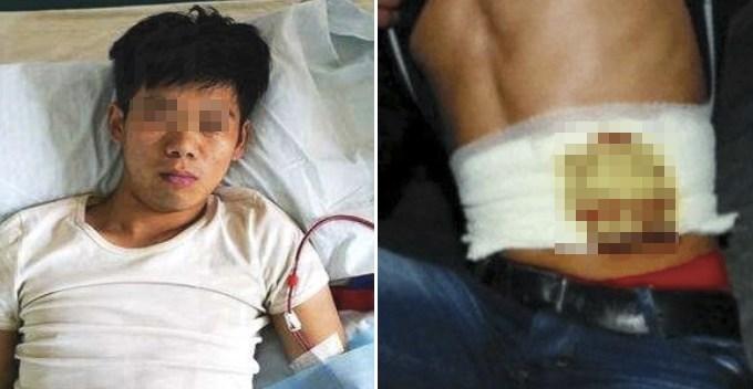 Și-a v&acirc;ndut un rinichi ca să &icirc;și poată cumpăra un iPhone. Prin ce trece t&acirc;nărul, la 8 ani de la decizia care i-a distrus viața