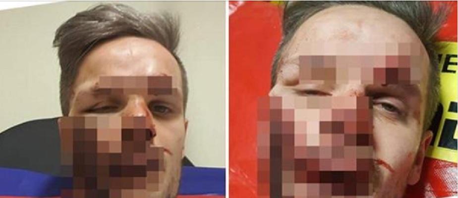 Desfigurat și lăsat &icirc;ntr-o baltă de s&acirc;nge &icirc;n fața soției și a copiilor: &bdquo;Am simțit că mi s-a spart fața. Nu știu cine este&rdquo;