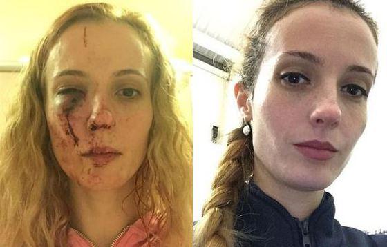 O rom&acirc;ncă, mama a doi copii, bătută cu bestialitate de mai mulți tineri, &icirc;n Marea Britanie: &rdquo;Au luat foc și au sărit pe mine!&rdquo; Ce le ceruse femeia