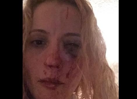 O româncă stabilită în Anglia, bătută și umilită de 10 tineri: „Au sărit pe mine și nimeni nu a intervenit să mă salveze”