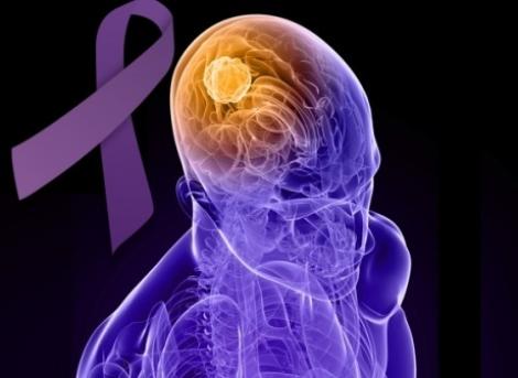 26 martie, Ziua Mondială a Epilepsiei. Tot ce trebuie să știi despre această boală