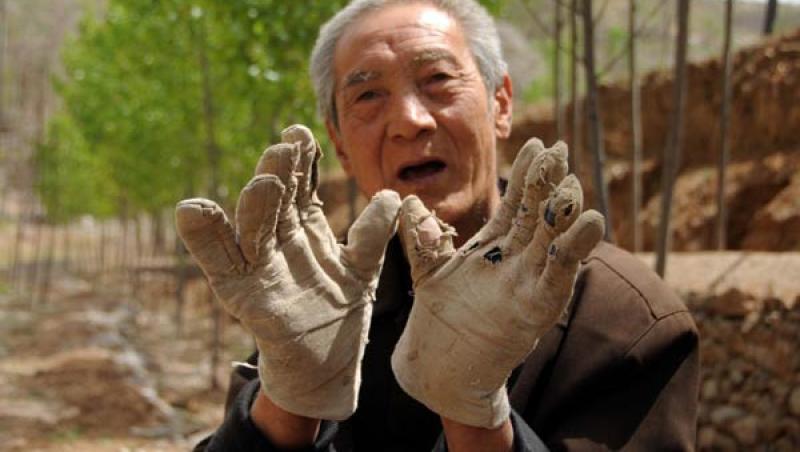Un bătrân de 70 de ani, fără ambele picioare, a plantat mii de pomi în satul în care locuiește