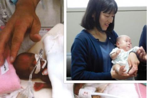 Cel mai mic bebeluș, de 258 de grame, a supraviețuit miraculos și a fost externat după un an de la naștere