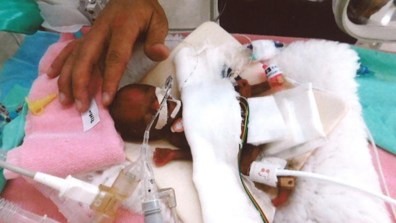 Cel mai mic bebeluș, de 258 de grame, a supraviețuit miraculos și a fost externat după un an de la naștere