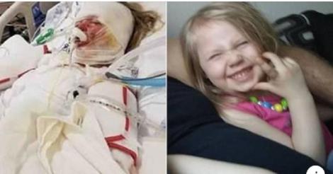Imagini cu puternic impact emoțional. Fetiță de 6 ani, desfigurată din cauza unei neglijențe oribile: Și-a pierdut jumătate dintre degetele de la mâini și picioare