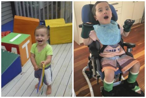Un copil de doi ani a rămas paralizat și a suferit leziuni cerebrale grave după ce a mâncat măr la creșă! Părinții: ”Abia poate să-și deschidă ochii!”