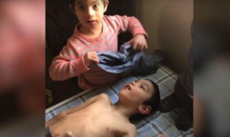 Dragostea de frate nu are limite! Un băiețel de 4 ani cu Sindromul Down își îngrijește cu toată dragostea cei 2 frați paralizați! Video