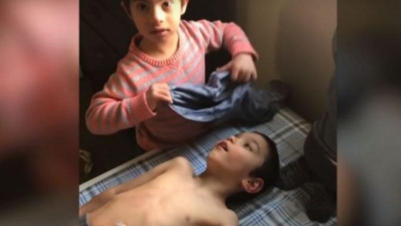 Dragostea de frate nu are limite! Un băiețel de 4 ani cu Sindromul Down își îngrijește cu toată dragostea cei 2 frați paralizați! Video