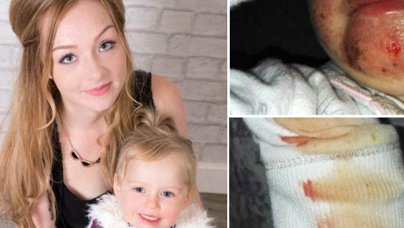 Te înfiori! O fetiță de 3 ani a fost la un pas de moarte după ce unul dintre apropiații familiei a pupat-o! Mama copilei avertizează toți părinții