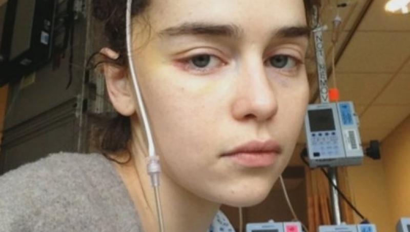 Actrița Emilia Clarke, imagini de pe patul de spital, de când a suferit primul anevrism cerebral: ”I-am rugat pe medici să mă lase să mor!”