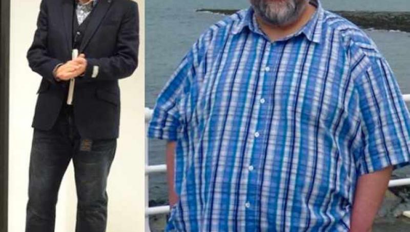 A slăbit 127 kilograme în doi ani cu cea mai simplă dietă. Purta mărimea 8XL