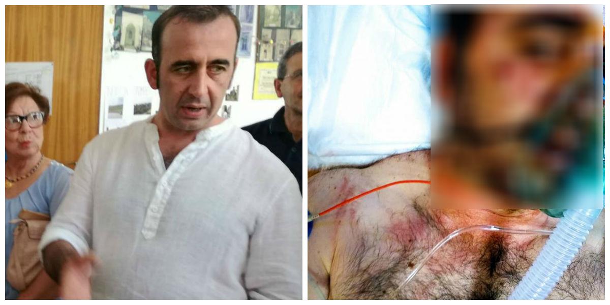 Un om de afaceri a fost desfigurat de trei țigani: &rdquo;M-au lovit cu pumnii și cu picioarele, iar apoi au &icirc;ncercat să mă stranguleze!