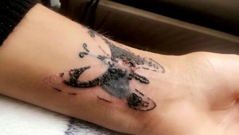 Șocant! Drama trăită de o fată care a vrut să-și facă un tatuaj la un tatuator cu prețuri mai mici: 