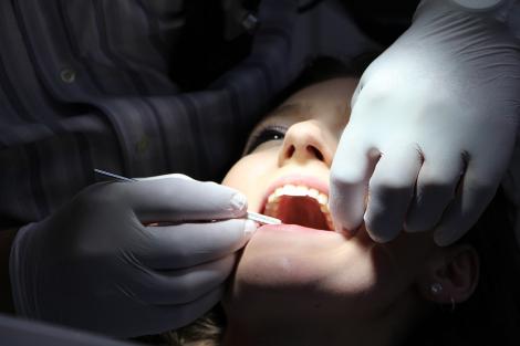 Ce înseamnă un implant dentar